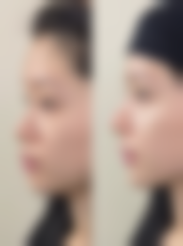 【集安徐秀云外科整形诊所特色项目:】