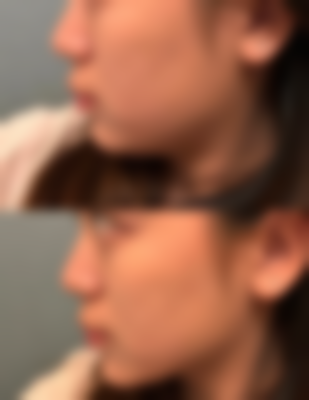 徐州爱尔美美容医院是正规的吗?