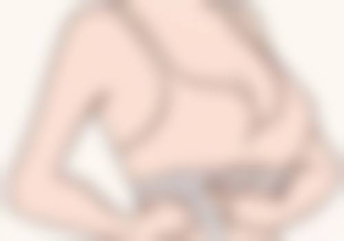 自体丰太阳穴成活率多少