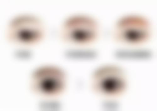 阴道壁突出可以怀孕吗