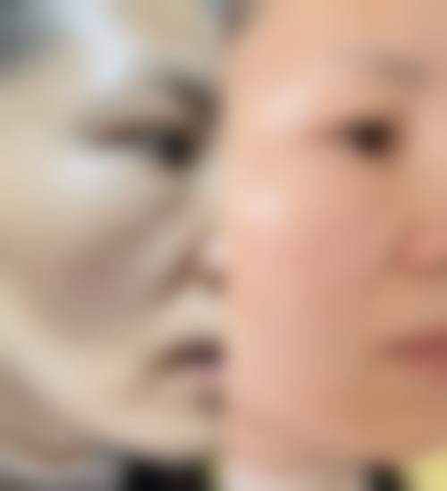 【龚业青医生擅长项目】