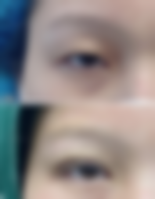 阴道壁突出有什么危害