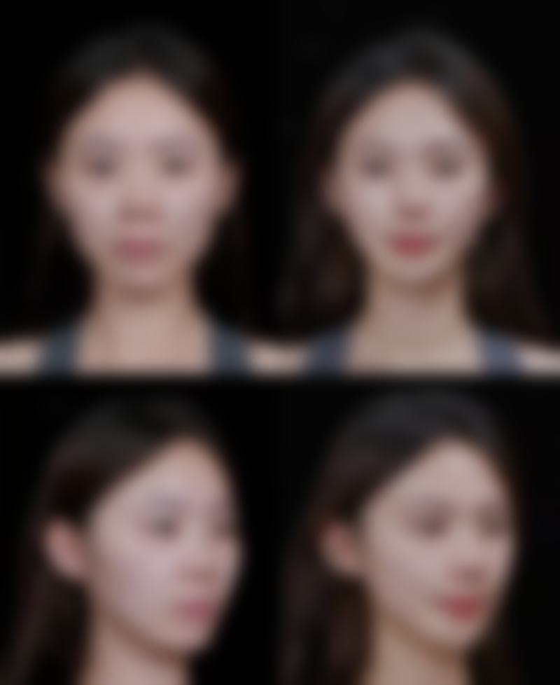 【崔元英医生技术特点：】