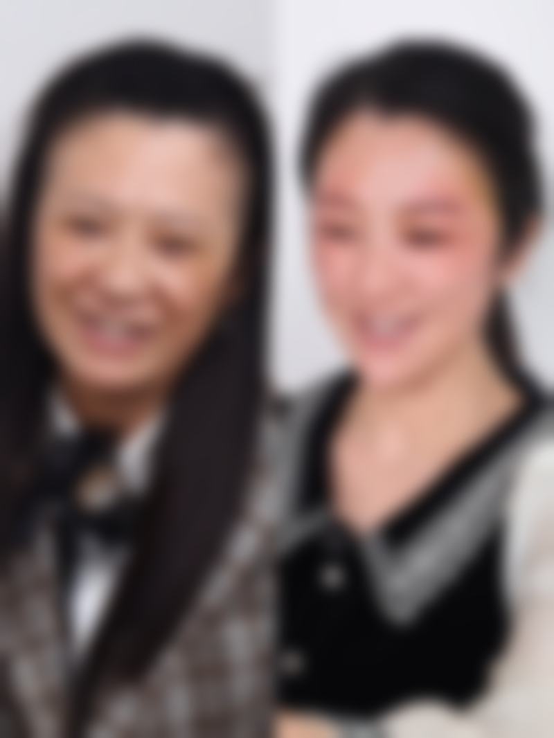 除皱针多久可以见到成效