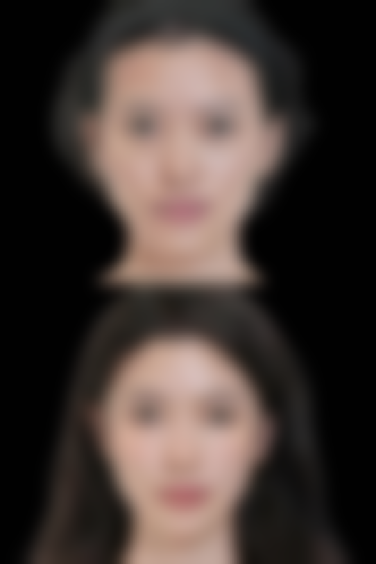 除皱针可以维持多长时间