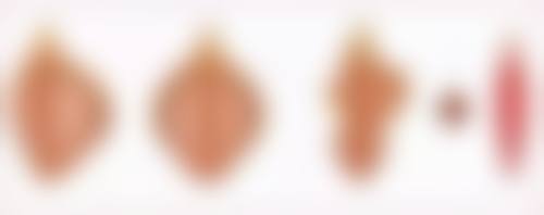 咬肌大适合打瘦脸针吗