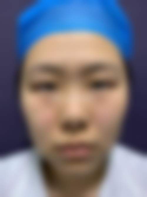 【王国明医生擅长项目】