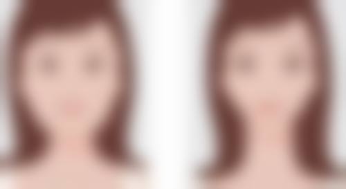 打美白针可以让肤色均匀吗