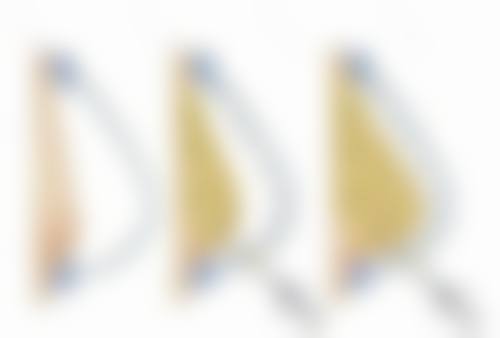 为什么嘴唇会变厚外翻