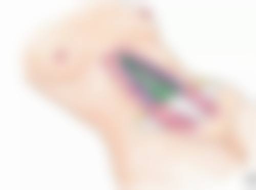 厚唇改薄后又反弹是怎么回事