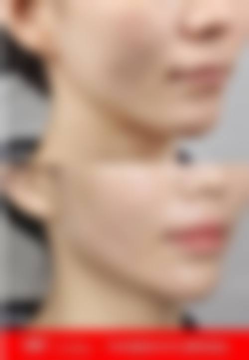 【邢台仁爱整形美容医院诊疗设备:】