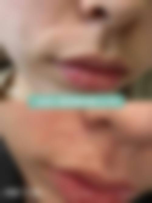 【湛江中 心人民医院(整形外科)怎么预约挂号?】