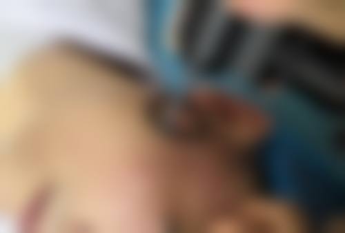 注射瘦脸针有没有效？揭秘90%人变美秘诀，专业分析其效果原理，让你轻松拥有小V脸！ 