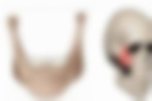 注射玻尿酸的危害和后遗症