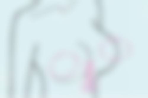 打瘦脸针后多久能怀孕