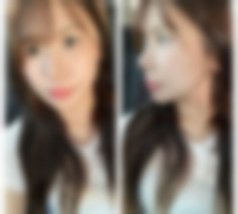 患者可通过电话或医院法定网站进行预约,建议提前预约以便安排医生和时间。这样就可以避免到院后等待的时间过长,让你的变得更美之旅更加顺畅。