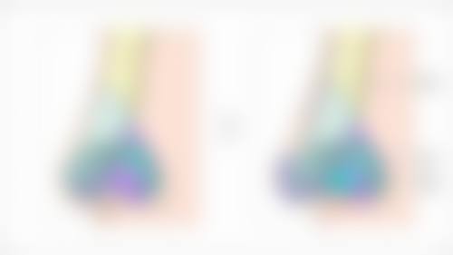 瘦脸针与轮廓针的区别