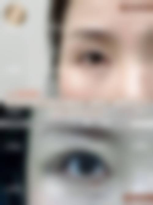 【徐允虎医生擅长项目】