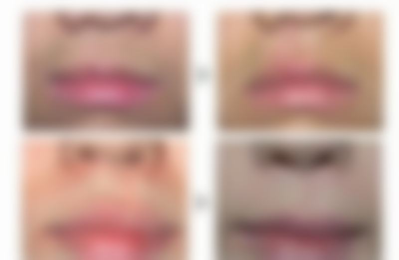 【金华婷如韵整形医院怎么预约挂号?】