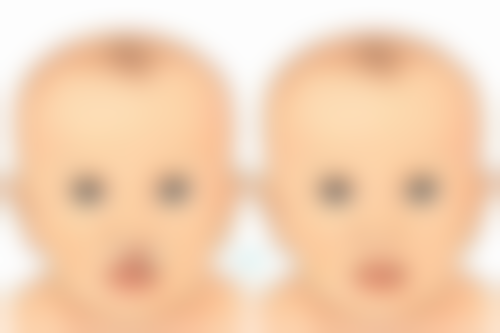 打完瘦脸针不酸胀该怎么办