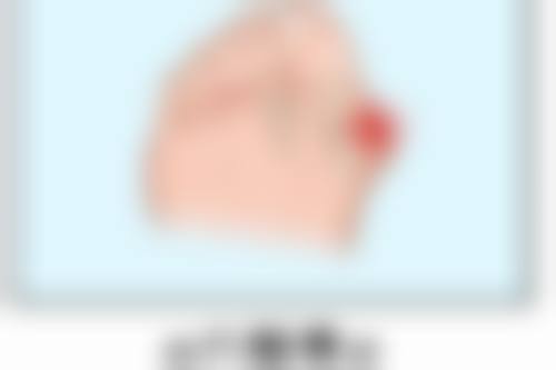 打完瘦脸针不酸胀是不是不管用？揭晓真相！这3种原因让不酸胀也能实现理想瘦脸效果 