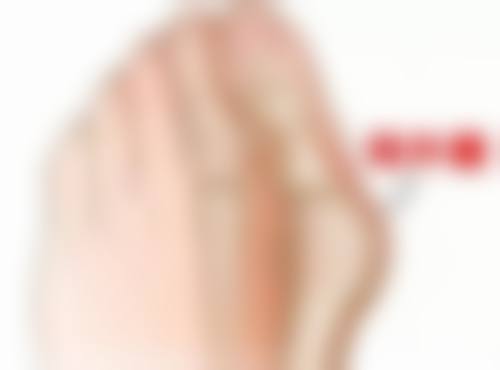 打完消炎针多久可以运动