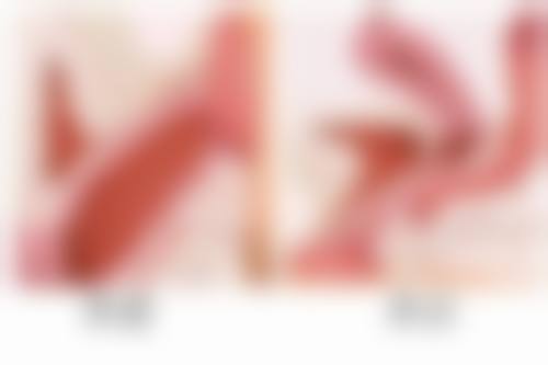 打过消炎针多久可以喝酒