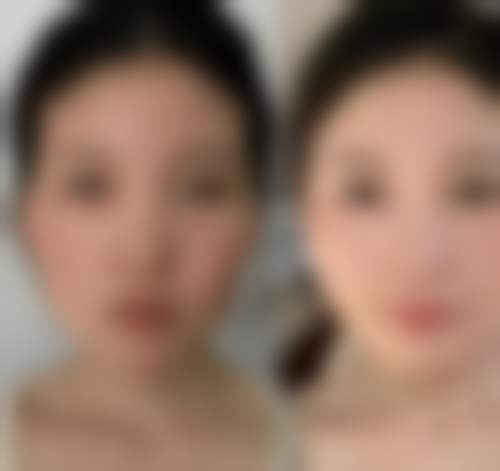 【詹艳伟医生怎么预约挂号？】