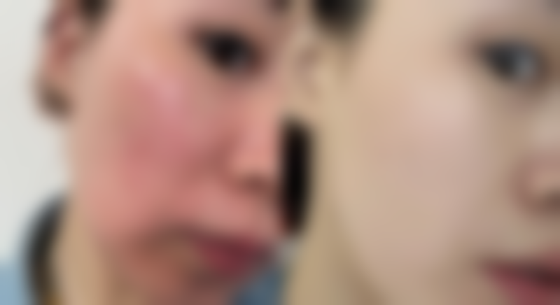 【邯郸莱媚俪整形医院怎么预约挂号?】