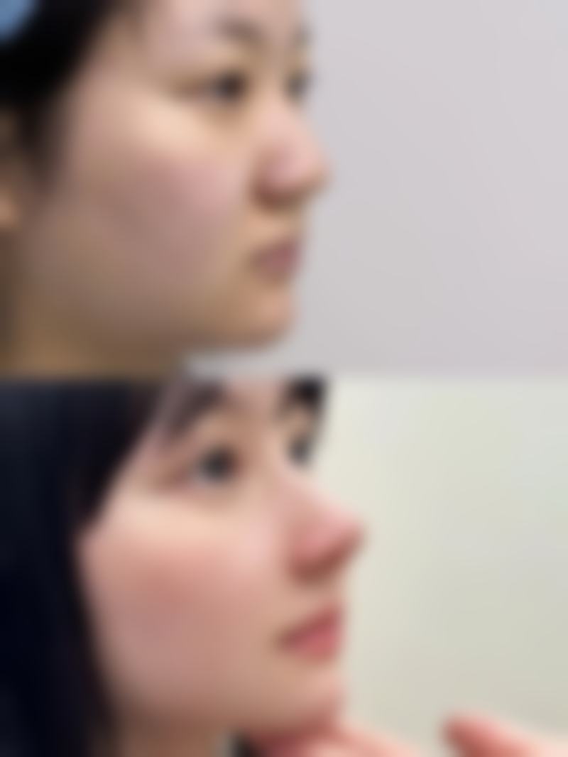 【邯郸莱媚俪整形医院特色项目：】