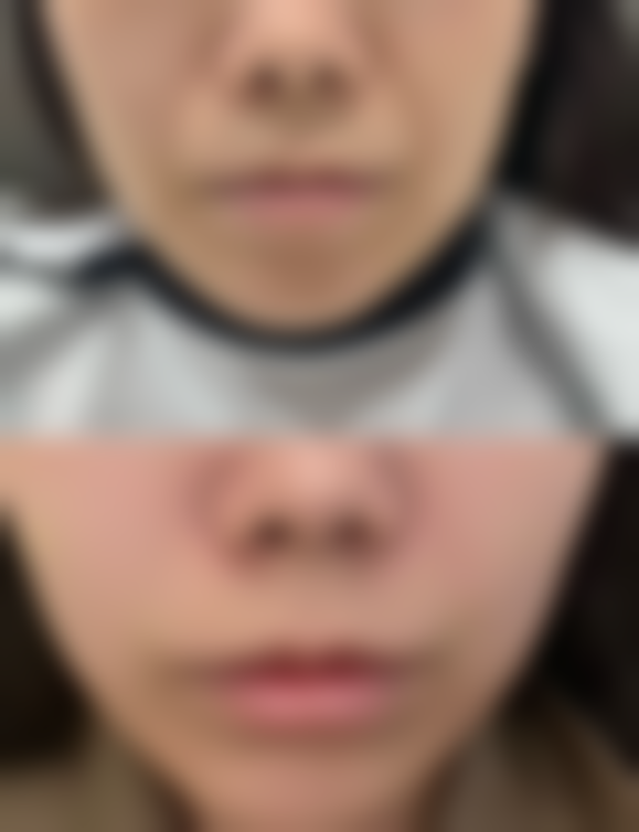 【杨士常医生技术特点：】