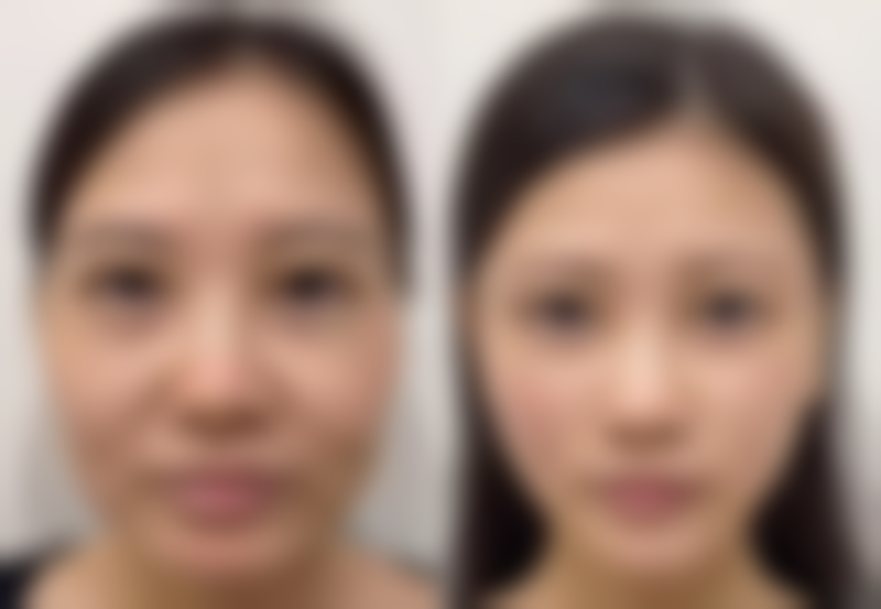 【三亚华美医疗美容医院怎么预约挂号?】