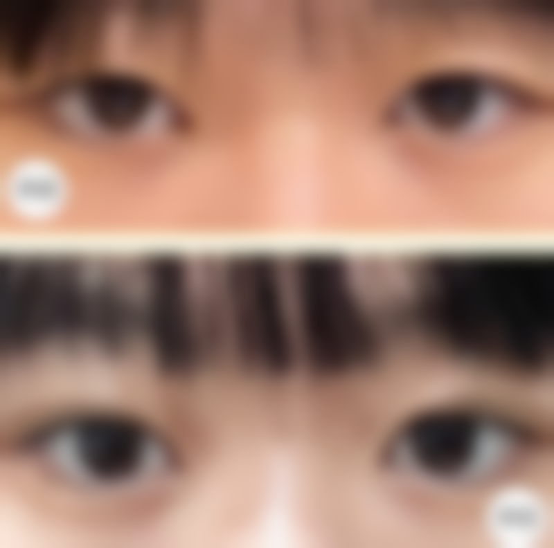 【蔡超秋医生擅长项目】