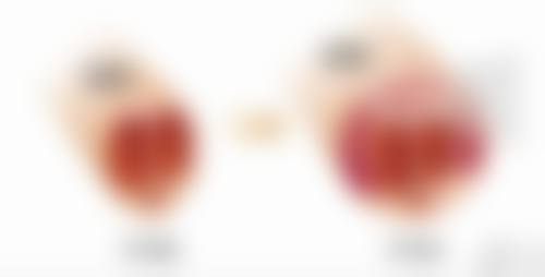 瘦脸针打完多久出效果？最快1周显效，了解三大影响因素，助你轻松拥有理想巴掌脸！ 