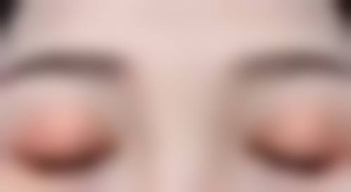 初期（1 - 7天）