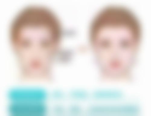 瘦脸针一般多久可以看到成效