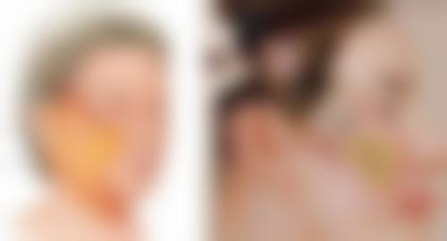 正规医院打除皱针的价格及影响因素