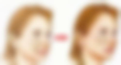 瘦脸针打完多久成效更明显