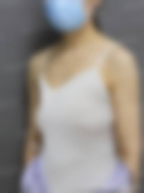 河南漯河源汇区人民医院整形科特色项目：