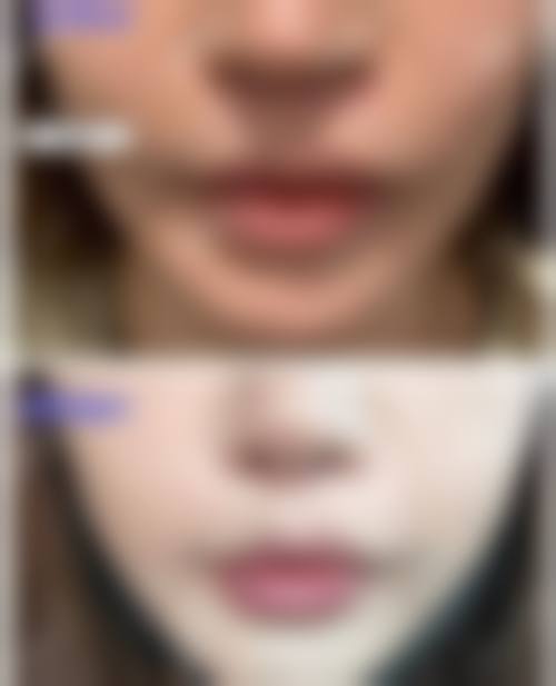 【成都蓉美和谐整形美容门诊部怎么预约挂号?】