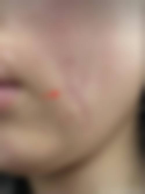 【林彬医生怎么预约挂号？】