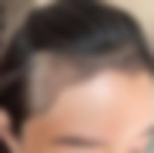 【林彬医生技术特点】