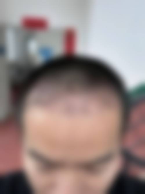 【林彬医生擅长项目】