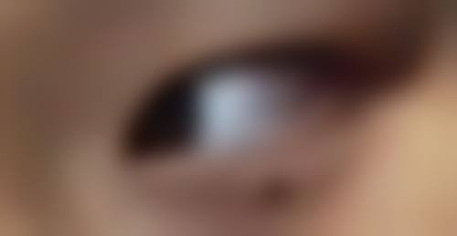 瘦脸针的价格和维持时间