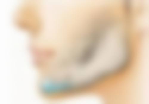 瘦脸针的注射相关问题