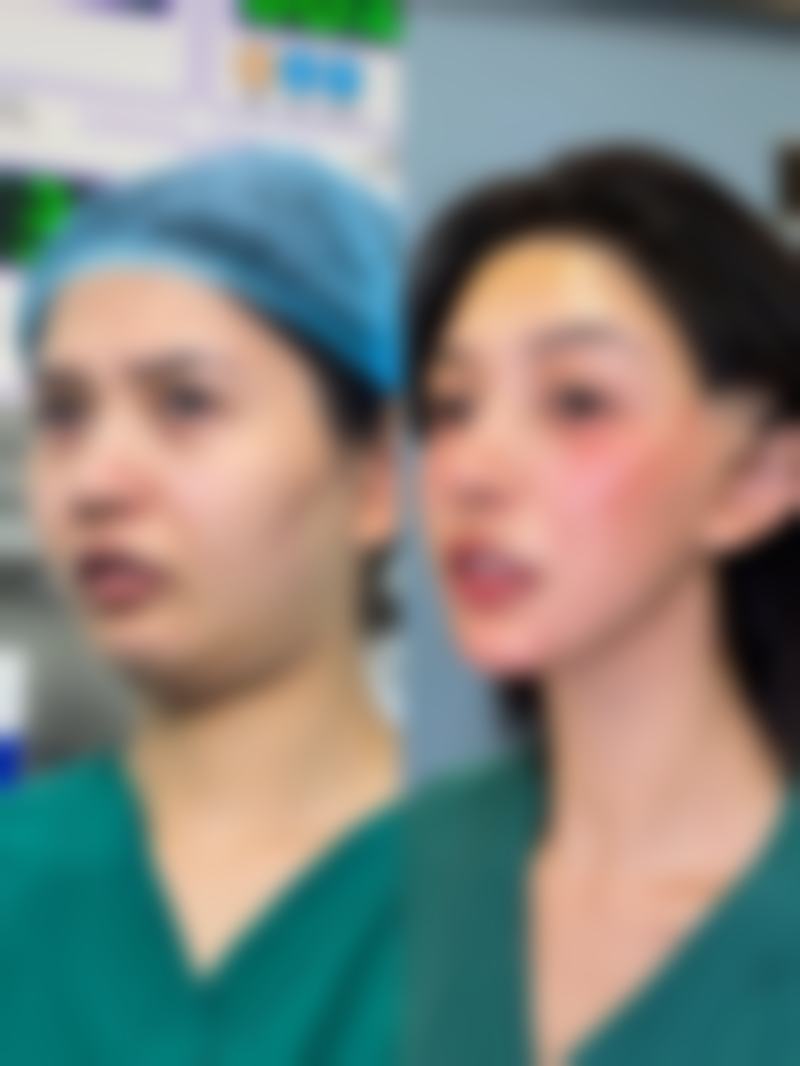 打瘦脸针影响运气