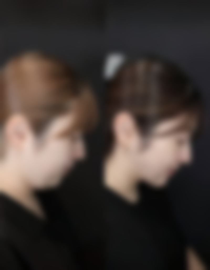 少女针可以管多久