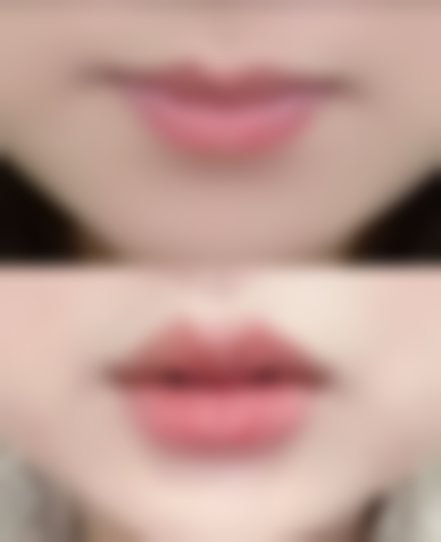 【云南昆明玛莉亚整形医院地址：】