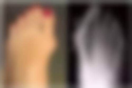 毛发种植前要注意哪些？了解3大关键事项，掌握5个实用医美小技巧，让植发效果事半功倍！ 