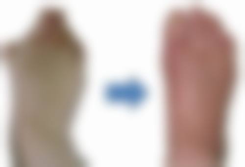 45岁打瘦脸针的注意事项